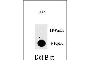 Dot blot analysis of anti-P3K7IP1-p Phospho-specific Pab (ABIN389806 and ABIN2839699) on nitrocellulose membrane. (TAB1 anticorps  (pSer423))