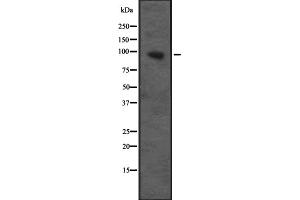 Western blot analysis of CUL4B expression in Transfected 293T cell lysate,The lane on the left is treated with the antigen-specific peptide.