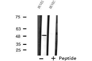 Western blot analysis of extracts from HUVEC cells using FOXD3 antibody. (FOXD3 anticorps  (Internal Region))