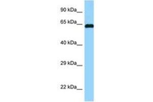 Image no. 1 for anti-Abl-Interactor 1 (ABI1) (AA 122-171) antibody (ABIN6748110) (ABI1 anticorps  (AA 122-171))