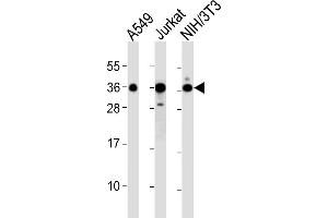 All lanes : Anti-DKK1 Antibody at 1:2000 dilution Lane 1: A549 whole cell lysates Lane 2: Jurkat whole cell lysates Lane 3: NIH/3T3 whole cell lysates Lysates/proteins at 20 μg per lane.