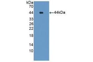 Detection of Recombinant Glutamine Synthetase, Human using Polyclonal Antibody to Glutamine synthetase (GS)