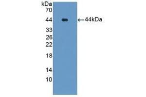 Detection of Recombinant Glutamine Synthetase, Human using Polyclonal Antibody to Glutamine synthetase (GS) (GLN1 anticorps  (AA 1-373))