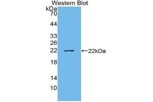 Detection of Recombinant VEGI, Rat using Polyclonal Antibody to TNF Like Ligand 1A (TL1A) (TNF Like Ligand 1A (AA 70-230) anticorps)