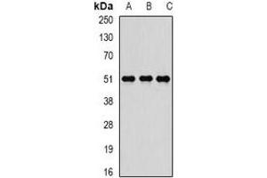 Western blot analysis of Reptin 52 expression in K562 (A), SW480 (B), MCF7 (C) whole cell lysates. (RUVBL2 anticorps)