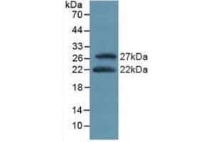 Detection of Recombinant ATF4, Mouse using Polyclonal Antibody to Activating Transcription Factor 4 (ATF4)