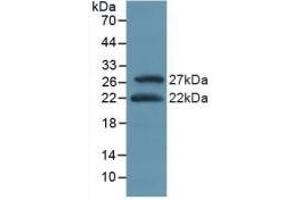 Detection of Recombinant ATF4, Mouse using Polyclonal Antibody to Activating Transcription Factor 4 (ATF4) (ATF4 anticorps  (AA 126-291))