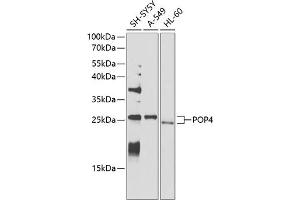 Western blot analysis of extracts of various cell lines, using POP4 antibody (ABIN6128482, ABIN6145964, ABIN6145966 and ABIN6220640) at 1:1000 dilution. (RPP29 anticorps  (AA 1-220))