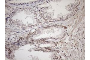 Immunohistochemistry (IHC) image for anti-Achalasia, Adrenocortical Insufficiency, Alacrimia (AAAS) (AA 322-546) antibody (ABIN2715861)
