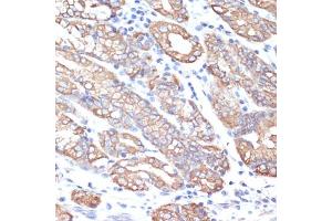 Immunohistochemistry of paraffin-embedded human small intestine using Cytokeratin 18 (KRT18) antibody (ABIN7268098) at dilution of 1:100 (40x lens).