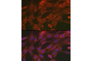 Immunofluorescence analysis of NIH/3T3 cells using [KO Validated] SOD2 Rabbit pAb (ABIN3021903, ABIN3021904, ABIN3021905 and ABIN6217382) at dilution of 1:200 (40x lens).
