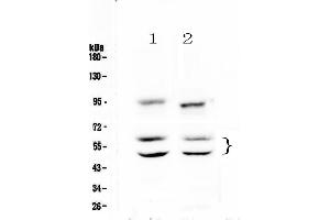 Western blot analysis of CaMKII alpha using anti-CaMKII alpha antibody . (CAMK2A anticorps  (AA 392-457))