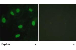 Immunofluorescence analysis of HeLa cells, using TBX15/TBX18 polyclonal antibody . (T-Box 15 anticorps)