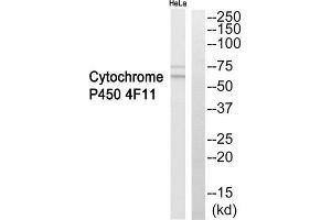 Western blot analysis of extracts from HeLa cells, using Cytochrome P450 4F11 antibody. (CYP4F11 anticorps  (Internal Region))