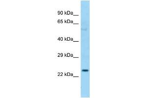 Host: Rabbit Target Name: CFHR2 Sample Type: OVCAR-3 Whole cell lysates Antibody Dilution: 1. (CFHR2 anticorps  (C-Term))