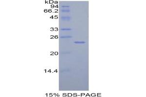 SDS-PAGE analysis of Rat TIMP4 Protein. (TIMP4 Protéine)