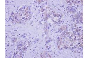 Image no. 1 for anti-UDP-N-Acetyl-alpha-D-Galactosamine:polypeptide N-Acetylgalactosaminyltransferase 2 (GalNAc-T2) (GALNT2) (AA 272-523) antibody (ABIN1498370)