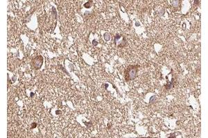 ABIN6267615 at 1/100 staining human brain tissue sections by IHC-P. (GRIN1/NMDAR1 anticorps  (pSer890))