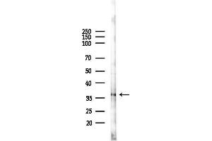 anti-Protein Phosphatase 2, Catalytic Subunit, beta Isozyme (PPP2CB) (C-Term) antibody