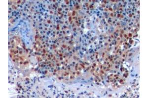 Detection of PCNA in Human Tonsil Tissue using Polyclonal Antibody to Proliferating Cell Nuclear Antigen (PCNA) (PCNA anticorps  (AA 6-261))