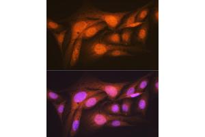 Immunofluorescence analysis of U-2 OS cells using p70 S6 Kinase 2 Rabbit mAb (ABIN7270034) at dilution of 1:100 (40x lens).