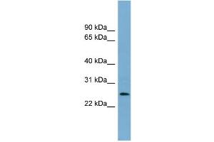 WB Suggested Anti-LIN37 Antibody Titration: 0. (LIN37 anticorps  (Middle Region))
