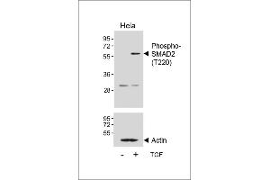Western blot analysis of lysates from Hela cell line, untreated or treated with TGF-β, 100 ng/mL, 30 min, using Phospho-SD2 Antibody (ABIN650816 and ABIN2839794) (upper) or Beta-actin (lower). (SMAD2 anticorps  (pThr220))