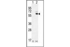 Western blot analysis of KNG1 (arrow) using Kininogen-1 Antibody (N-term) Cat.