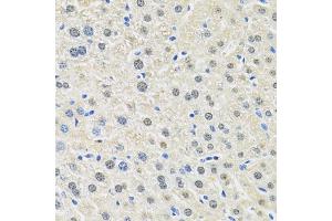 Immunohistochemistry of paraffin-embedded mouse liver using SLC3A2 antibody.