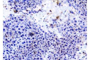 anti-TRAF Family Member-Associated NFKB Activator (TANK) antibody