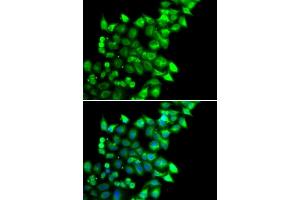 Immunofluorescence analysis of U2OS cells using MEST antibody (ABIN6133292, ABIN6143749, ABIN6143751 and ABIN6222673). (MEST anticorps  (AA 146-335))