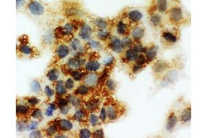 Anti-Cortisol Binding Globulin antibody, ICC ICC: HEPG2 Cell