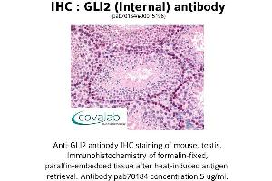 Image no. 1 for anti-GLI Family Zinc Finger 2 (GLI2) (Internal Region) antibody (ABIN1734718) (GLI2 anticorps  (Internal Region))