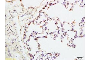 Formalin-fixed and rat lung tissue labeled with Anti-IQGAP1 Polyclonal Antibody, Unconjugated  at 1:200 followed by conjugation to the secondary antibody and DAB staining (IQGAP1 anticorps  (AA 1451-1550))