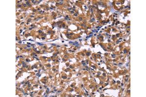 Immunohistochemistry (IHC) image for anti-Selectin P Ligand (SELPLG) antibody (ABIN2422074) (SELPLG anticorps)
