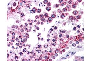 Immunohistochemistry (IHC) image for anti-Wingless-Type MMTV Integration Site Family, Member 5B (WNT5B) (Middle Region) antibody (ABIN2776725)