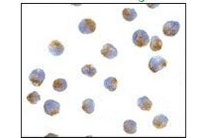 AP20056PU-N ATG7 antibody staining of L1210 cells by Immunocytochemistry at 10 μg/ml.