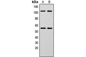 Western blot analysis of NF-kappaB p105/p50 (pS337) expression in HeLa (A), MCF7 (B) whole cell lysates. (NFKB1 anticorps  (pSer337))