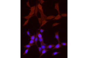 Immunofluorescence analysis of NIH/3T3 cells using BMP4 Rabbit pAb (ABIN6127497, ABIN6137600, ABIN6137603 and ABIN6215157) at dilution of 1:50 (40x lens). (BMP4 anticorps  (AA 1-408))