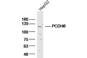 Lane 1: HepG2 lysates probed with Anti PCDH8 Polyclonal Antibody, Unconjugated (bs-11114R) at 1:300 overnight at 4˚C. (Protocadherin 8 anticorps  (AA 51-150))
