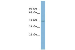 WB Suggested Anti-ZCCHC12 Antibody Titration: 0. (ZCCHC12 anticorps  (Middle Region))