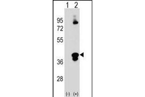 Western blot analysis of C1QTNF1 (arrow) using rabbit polyclonal C1QTNF1 Antibody (N-term) (ABIN390541 and ABIN2840881).