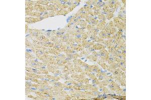 Immunohistochemistry of paraffin-embedded mouse heart using INPP5J Antibody (ABIN5973988) at dilution of 1/100 (40x lens). (INPP5J anticorps)