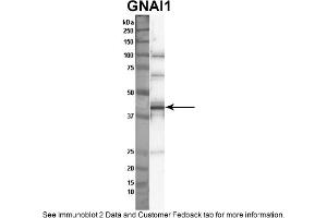 Sample Type: Nthy-ori cell lysate (50ug)Primary Dilution: 1:1000Secondary Antibody: anti-rabbit HRPSecondary Dilution: 1:2000Image Submitted By: Anonymous