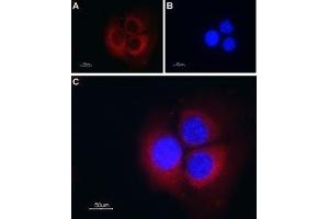 Expression of TRIC-B in mouse muscle myoblast (C2C12) cell line - Immunocytochemical staining of mouse paraformaldehyde-fixed and permeabilized muscle myoblast (C2C12) cell line.