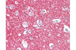 Anti-Amphiphysin antibody IHC of human brain, cortex. (Amphiphysin anticorps  (AA 1-347))