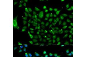 Immunofluorescence analysis of U2OS cells using NCOR1 Polyclonal Antibody (NCOR1 anticorps)