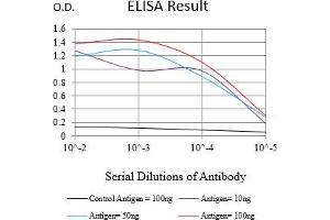 Black line: Control Antigen (100 ng),Purple line: Antigen (10 ng), Blue line: Antigen (50 ng), Red line:Antigen (100 ng)