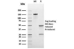 SDS-PAGE Analysis Purified BCL-6 Mouse Recombinant Monoclonal Antibody (rBCL6/1718).