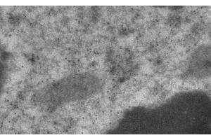 Immunogold labeling of epithelium Cells, in vivo injected with YFP expressing vector, (YFP anticorps)